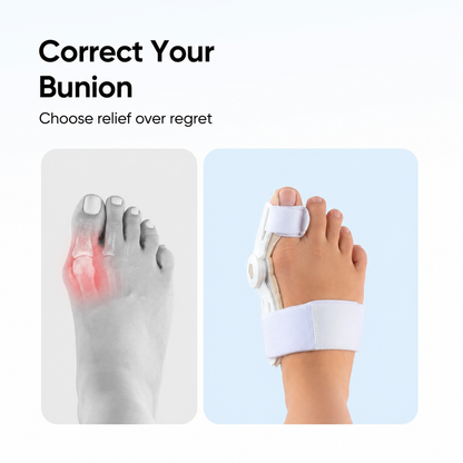 Comforta Toe Aligner