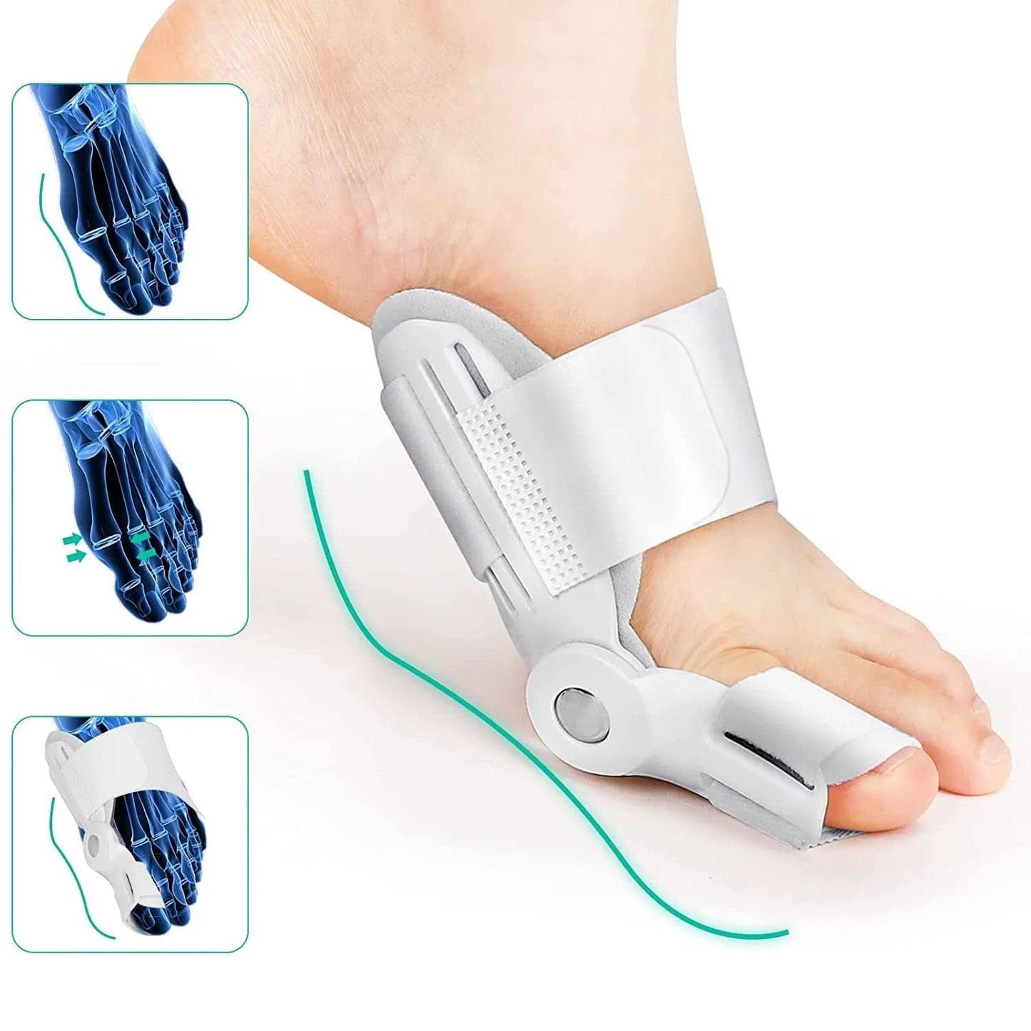 Comforta Ultimate Toe Aligner