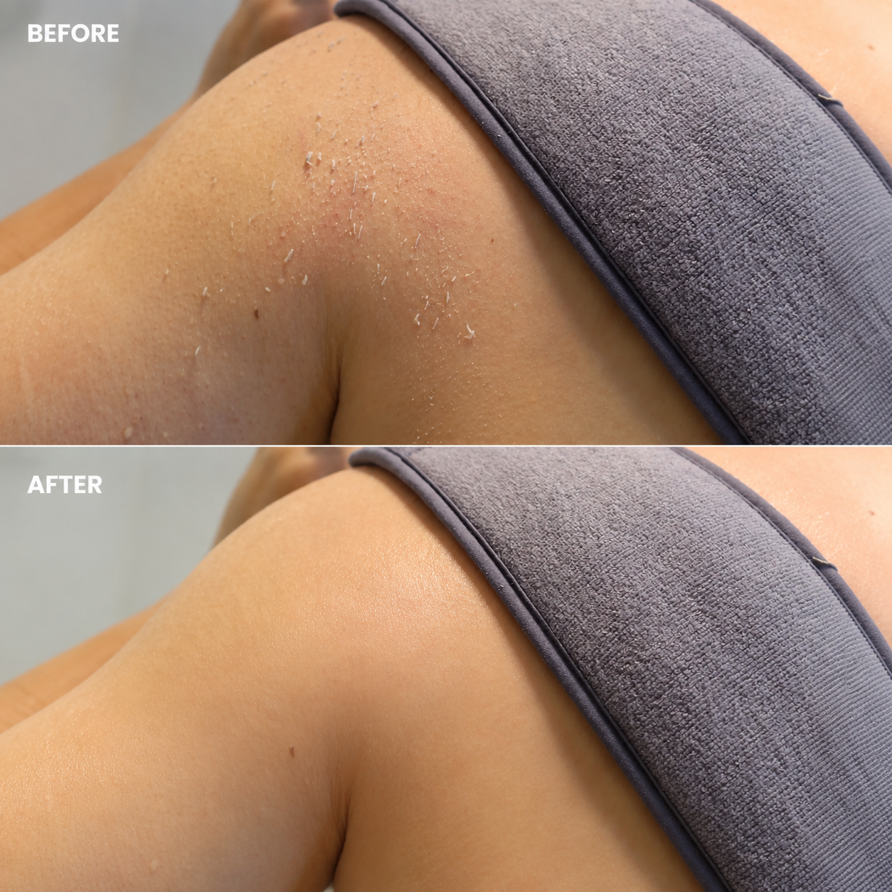 Full Body Exfoliating Kit