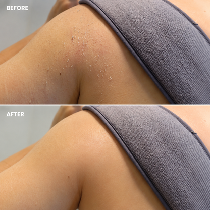 Full Body Exfoliating Kit